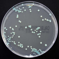 Thermo Scientific Oxoid Chromogenic Candida albicans Agar | Buy Online | Thermo Scientific&trade; | Fisher Scientific